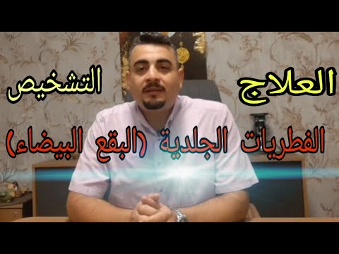 فيديو: ما هي الفطريات البيضاء الكبيرة؟