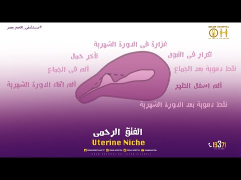 هو ده الفتق الرحمي يعنى عدم اكتمال العضلة الداخلية للرحم او انها تكتمل والسبب ايه شوف الفيديو للآخر