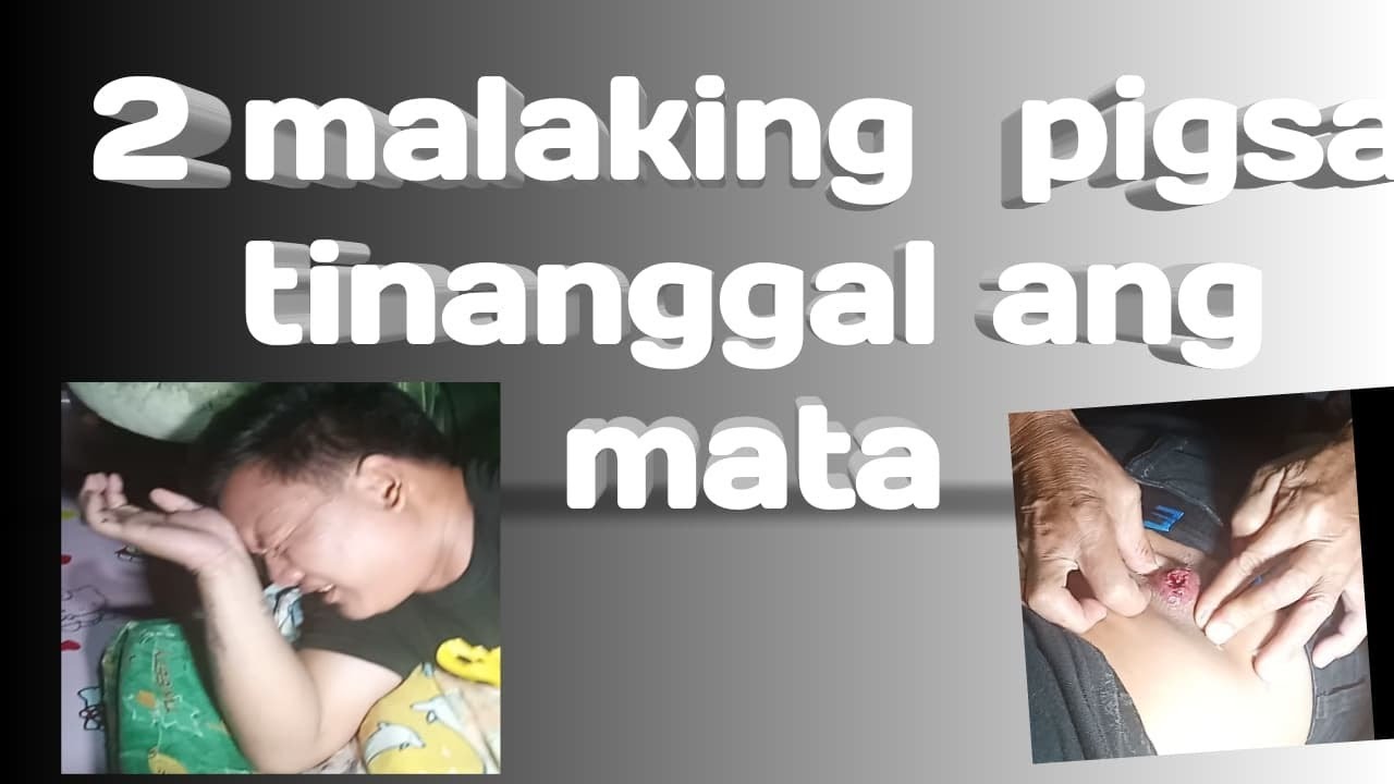 2 Malaking pigsa tinanggal ang mata - YouTube