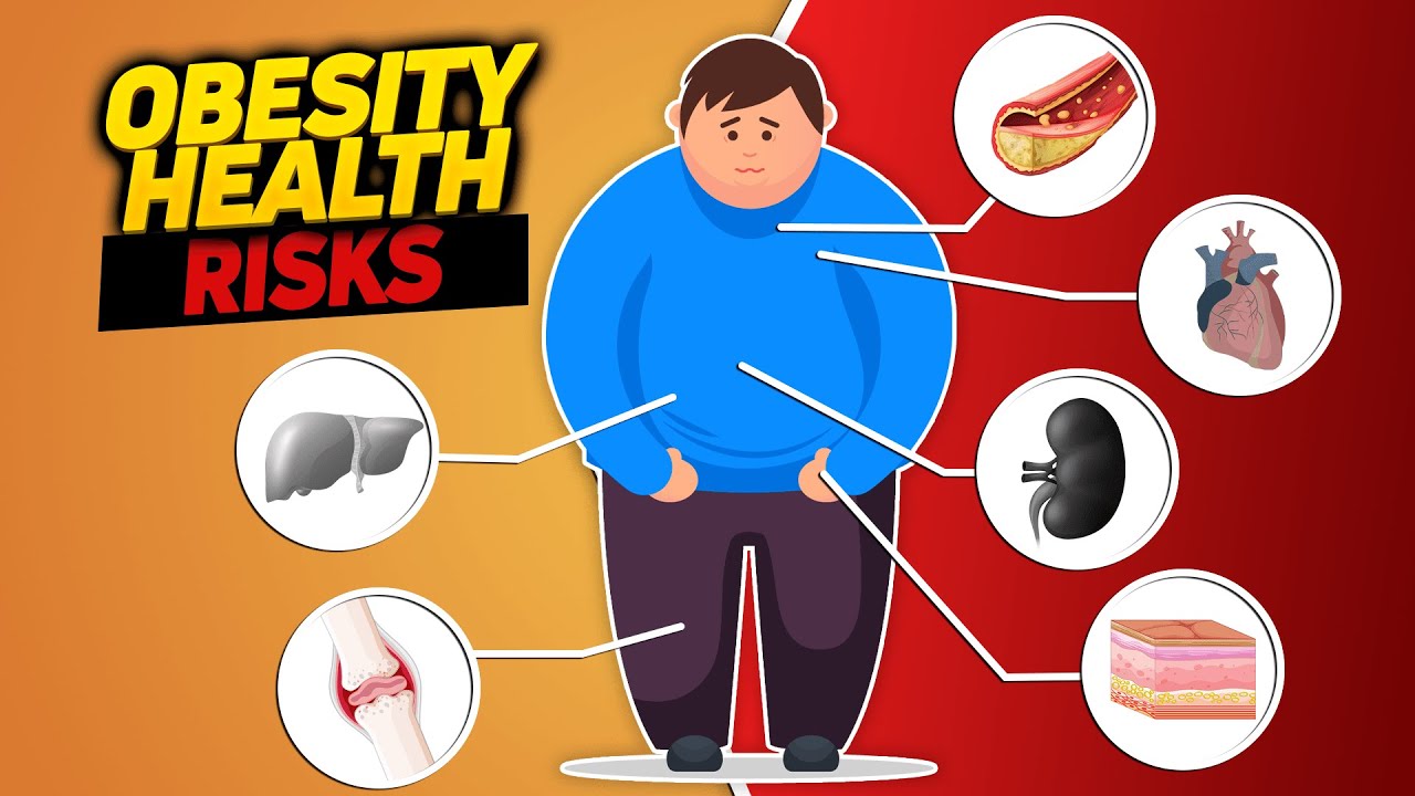 Obesity Health Risks Or How Excessive Fat Destroys The Body Youtube