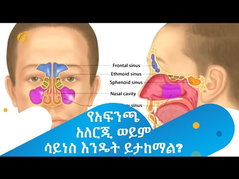 ቪዲዮ: ንፍጥ ለማድረቅ 3 መንገዶች