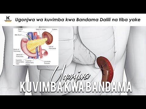 Ugonjwa wa kuvimba kwa Bandama Dalili na Tiba yake