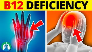 ⚠️ Top 10 Symptoms of Vitamin B12 Deficiency That You MUST Know