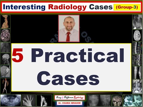 5 Interesting Radiology Cases (Episode 3)