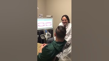 Invisalign simulation using iTero scanner
