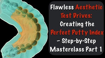 Flawless Aesthetic Test Drives: Creating the Perfect Putty Index – Step-by-Step Masterclass Part 1