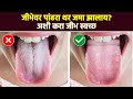 ज भ वर प ढर थर जम ह त ह उप य कर How To Clean Tongue RI2 ज भ वर प ढर थर जम ह त ह उप य कर How To Clean Tongue RI2