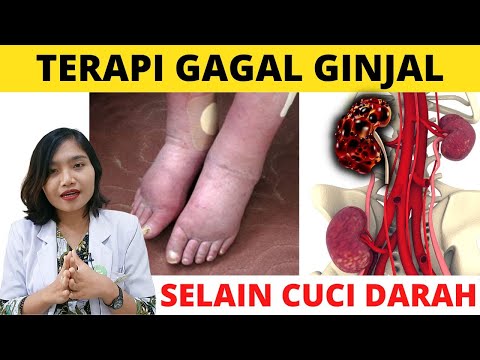 Video: 3 Cara Bersedia untuk Dialisis Ginjal