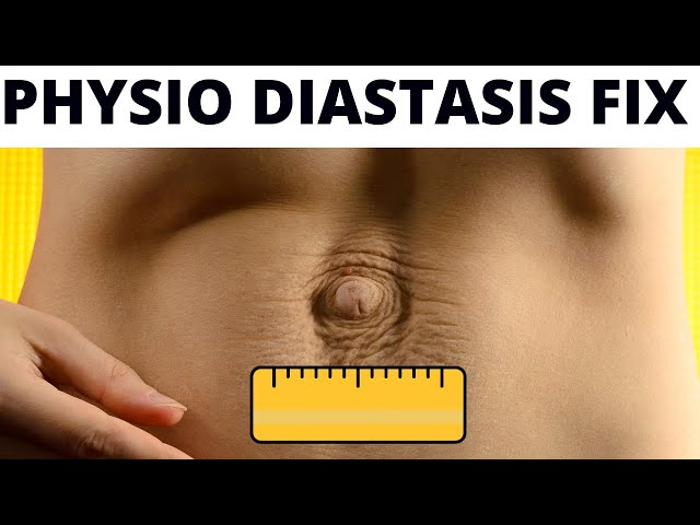 Heal Diastasis Recti FAST – Physiotherapy Guide to FIX & FLATTEN your BELLY  