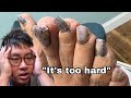 DOCTOR STRUGGLES TO CUT THICK PURPLE NAILS