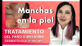 PAÑO/MELASMA, TRATAMIENTO y Tips de una Dermatóloga 👩🏻‍⚕️