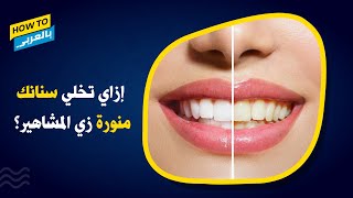 تبييض الاسنان.. إزاي تخلي سنانك منورة بطرق طبية آمنة؟