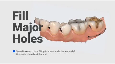 Medit i700 | Better for Patients, Easier for Dentists | Smart Software | Fill major holes