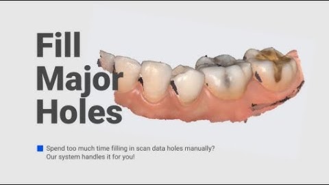Medit i700 | Better for Patients, Easier for Dentists | Smart Software | Fill major holes