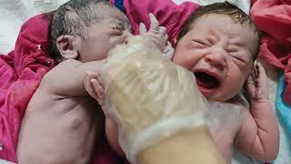 Chubby Twin newborn babies after birth