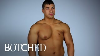 Albert Reveals His Surgical Nightmare in Mexico | Botched | E!