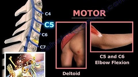 Neck Pain, Cervical Disc Herniation & Radiculopathy-Everything You Need To Know - Dr. Nabil Ebraheim