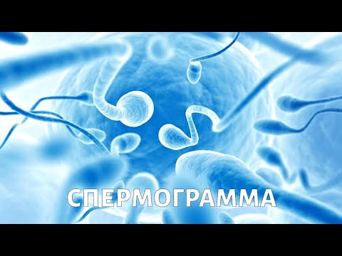 Метод исследования: спермограмма
