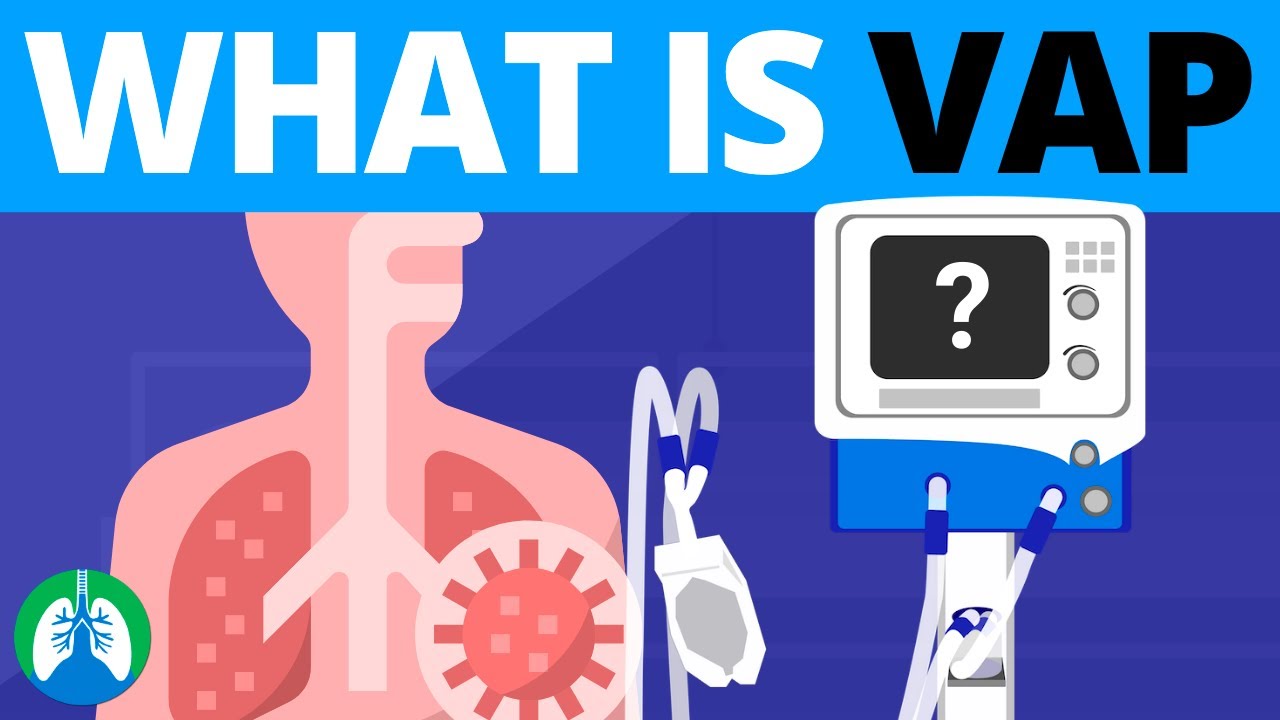 Ventilator-associated pneumonia (Vap). ��Spts классический Vap. Vap tpu ru