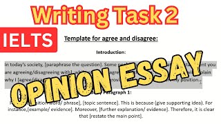 Opinion Essay with Sample | IELTS Writing Task 2 Template: Academic IELTS & General Training