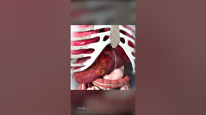 Liver Cancer Symptoms That are Often Overlooked