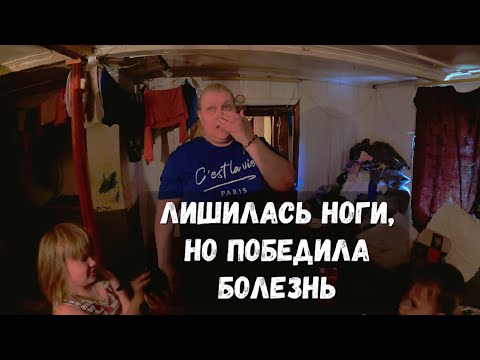 Видео: ЛИШИЛАСЬ НОГИ, РОДИЛА ДЕТЕЙ, НЕ ПАДАЕТ ДУХОМ!