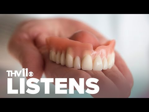 Video: Pokrývá medicaid dentální lepení?