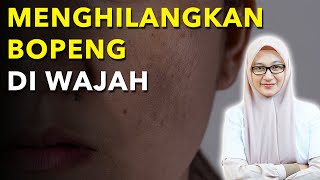 4 Cara Menghilangkan Jerawat