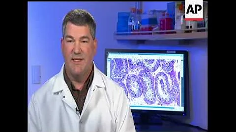 Too often, lifesaving childhood cancer treatments have a devastating side effect: infertility later