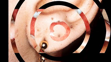 Thumbnail of Addison's Disease Awareness (Original Mix)