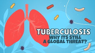Tuberculosis: Why It’s Still a Global Threat