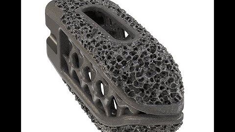 Modulus TLIF-O Procedural Animation