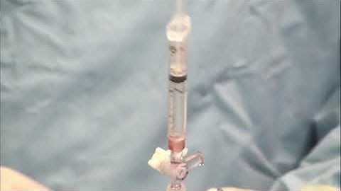 Stingray Balloon Prep