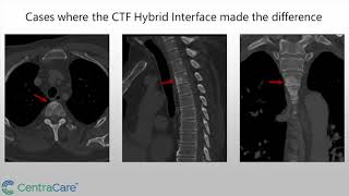 Dr. Yusuf Karrar, MD  - Simple, Streamlined CT Fluoroscopy