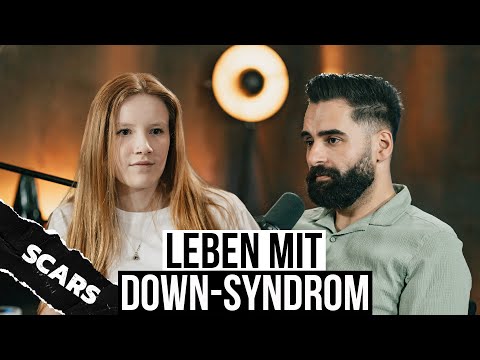 SCARS - Living with Down Syndrome (Trisomy 21) - Podcast with Said Ibrahim & Mia