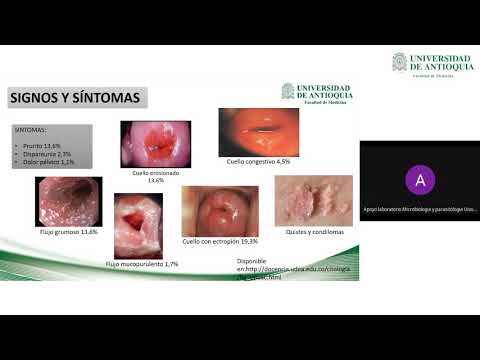 Vídeo: Inflamació Vaginal En Gossos