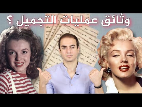 فيديو: كيف كان شكل سيرجي زفيريف قبل الجراحة التجميلية