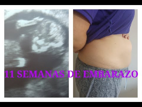 Video: 11 Semanas De Embarazo: Descripción, Barriga, Ultrasonido, Sensaciones