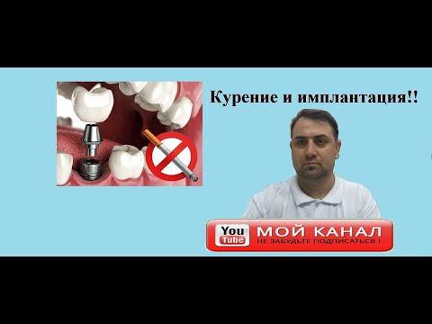 Часто задаваемые вопросы по имплантации. Курение и имплантация.