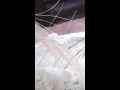 Morgellon's Fiber Feeds  on a Human Hair Strand and Looks at the camera.