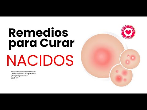 Remedios Caseros para Tratar los Forúnculos | Remedios Caseros Nacidos