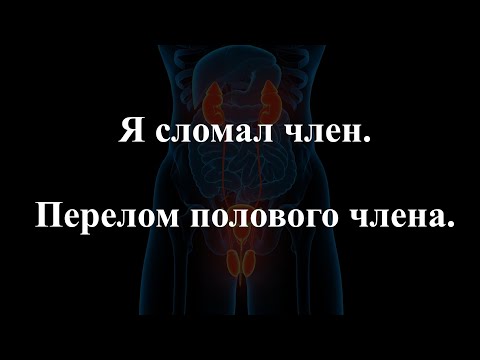 Я СЛОМАЛ ЧЛЕН. ПЕРЕЛОМ ПОЛОВОГО ЧЛЕНА.