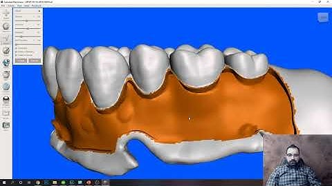 VITA VIONIC VIGO® with Eugene Royzengurt, DD