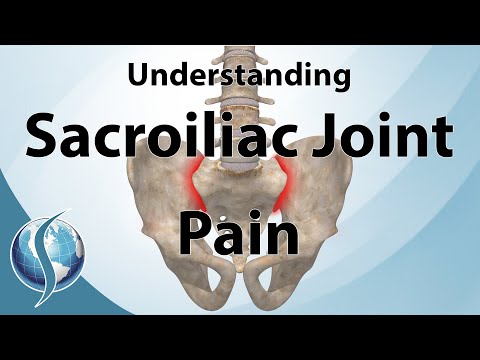 Understanding Sacroiliac Joint Pain