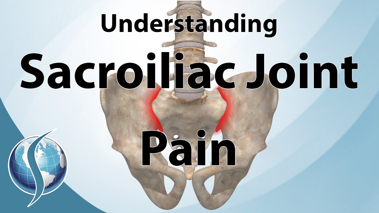 Understanding Sacroiliac Joint Pain