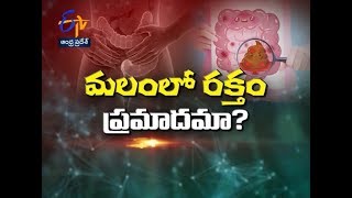 Blood In Motion - Is It Dangerous ? | Sukhibhava | 26th February 2019 | ETV Andhra Pradesh