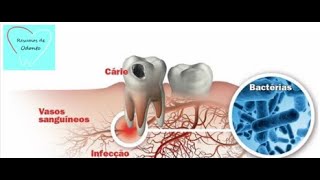 Cariologia - Resumos De Odonto