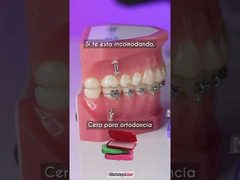 ¡Cómo cuidar los