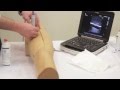 Ultrasound Guided Femoral Arterial Access