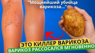 МОЩНЫЙ УБИЙЦА ВАРИКОЗА И СОСУДИСТЫХ ЗВЕЗДОЧЕК! За 5 минут... Ножки СТАЛИ ЧИСТЫЕ! 10 рецептов